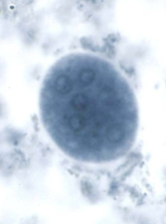 <p>Up to 8 nuclei</p><p>20-25 microns</p><p>Ecentic karyosome</p>
