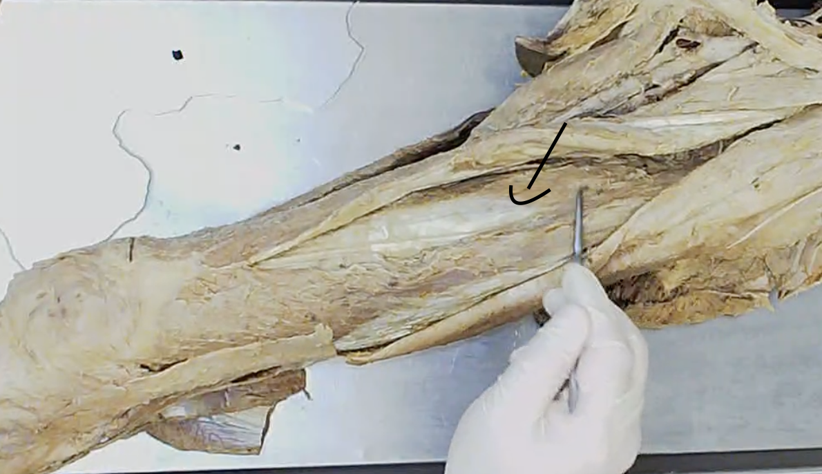 <p>Deep to rectus femoris</p>