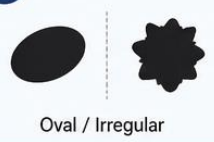 <p>Which shape is benign/malignant</p>
