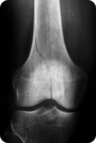 <p>Longitudinal</p>