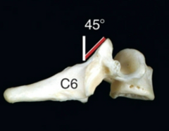<p>Cervical superior articular facets face?</p>