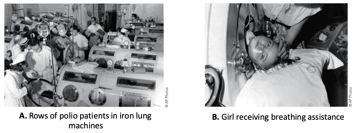 <p>Poliovirus is transmitted via the fecal–oral route.</p><ul><li><p>In most cases, a mild gastrointestinal illness results.</p></li><li><p>In a smaller percentage of cases, the virus “takes a wrong turn” and enters the central nervous system.</p><ul><li><p>This can result in varied degrees of paralysis.</p></li></ul></li></ul><p></p>