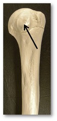 <p>Under the head, more medial bump</p>