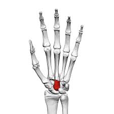 <p>What carpal is this?</p>