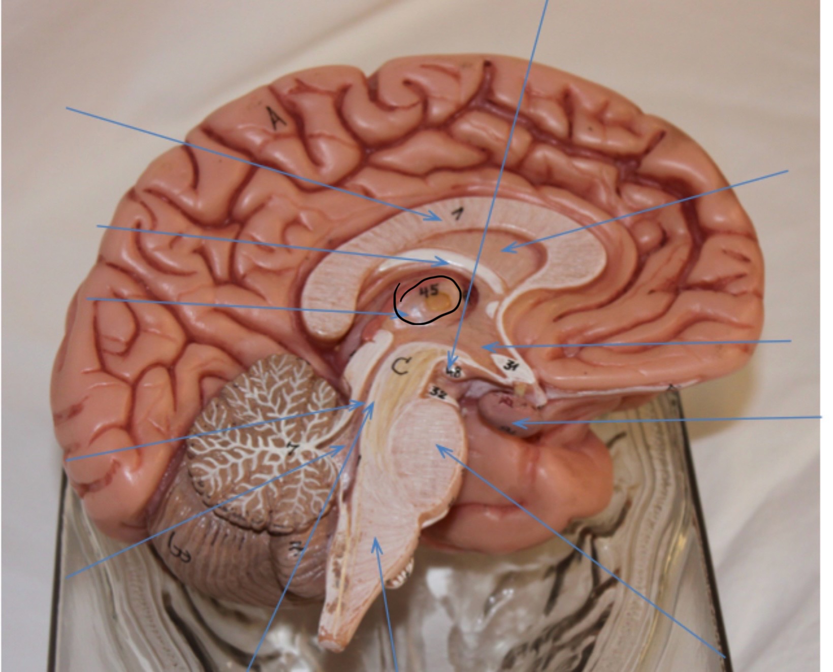 <p>Identify the circled area?</p>