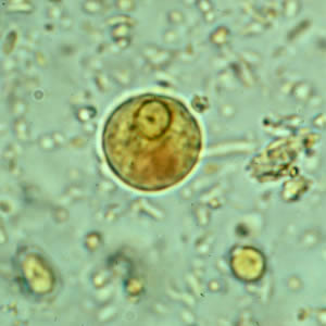 <p>Entamoeba histolytica Life Cycle </p>