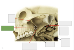 <p>Inferolateral view: This is the</p>