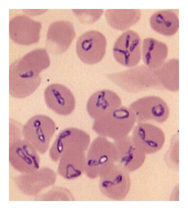 <p>Maltese cross formation in the RBC?</p>