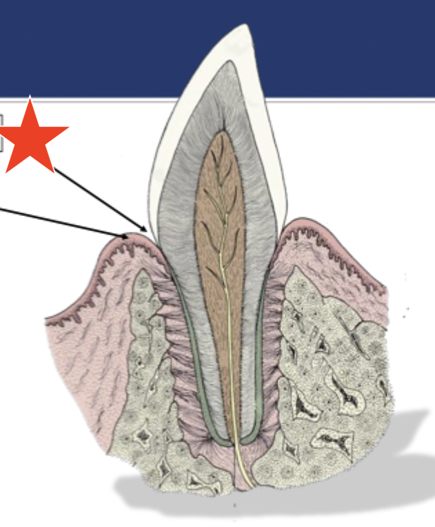 <p>What part of the tooth is indicated by the star?</p>