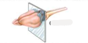 <p>wat voor hersensnede is dit?</p>