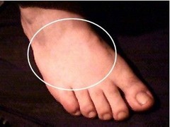 <p>The top or anterior surface of the foot.</p>