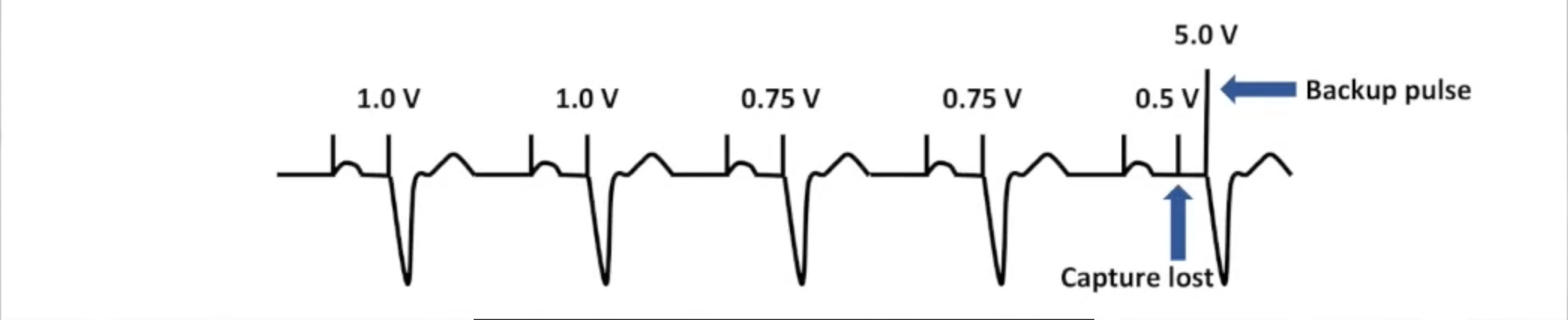 <ul><li><p>Run periodically by device</p></li><li><p>Gradually decrements outputs to look for loss of capture</p></li><li><p>No 2:1 safety margin</p></li><li><p>Paces to override intrinsic activity</p></li><li><p>Delays test for high intrinsic rate, algorithms</p></li><li><p>Backup pulse at elevated outputs when capture is lost</p></li></ul><p></p>