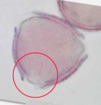 <p>Identify the circled aperture</p>