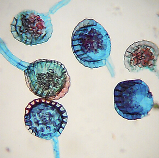 <p>Groups of these make Sori</p><p>Located on fern leaves </p>