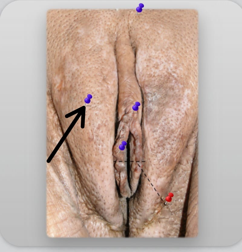 term image