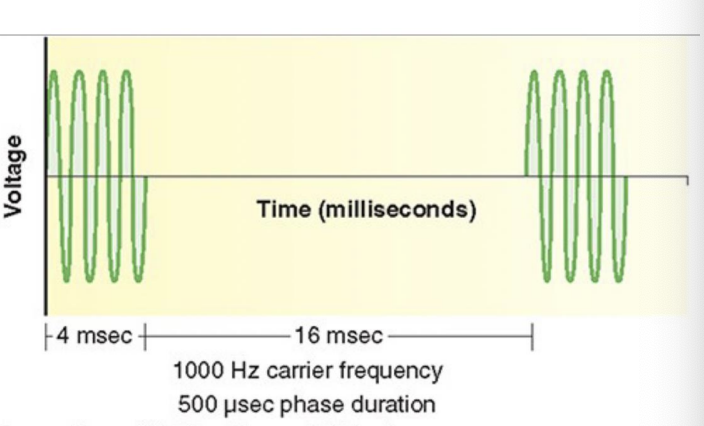 <ul><li><p>created from 1,000 Hz burst modulated AC </p></li><li><p>delivered in 4-msec bursts </p></li><li><p>greater torque production, efficiency, and decreased rate of muscle fatigue </p></li></ul><p></p>