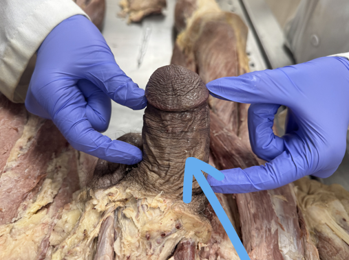 <p>allows for penetration for sperm to be released</p>