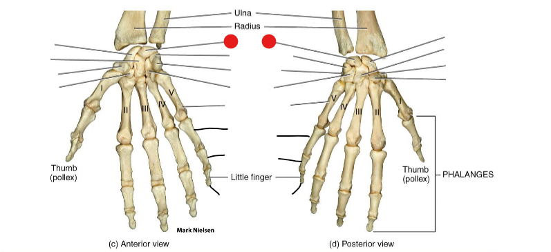 <p>Identify the structure pinned</p>