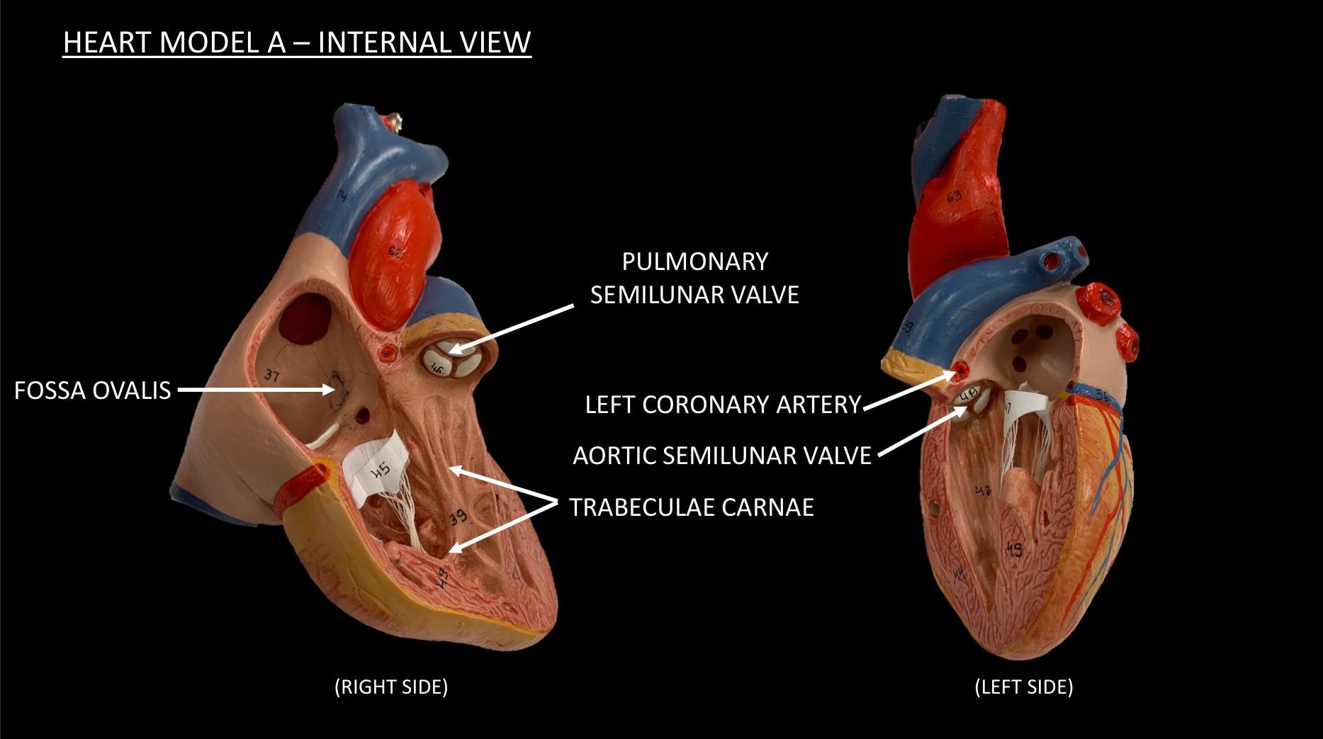 <p>TRABECULAE CARNAE</p>