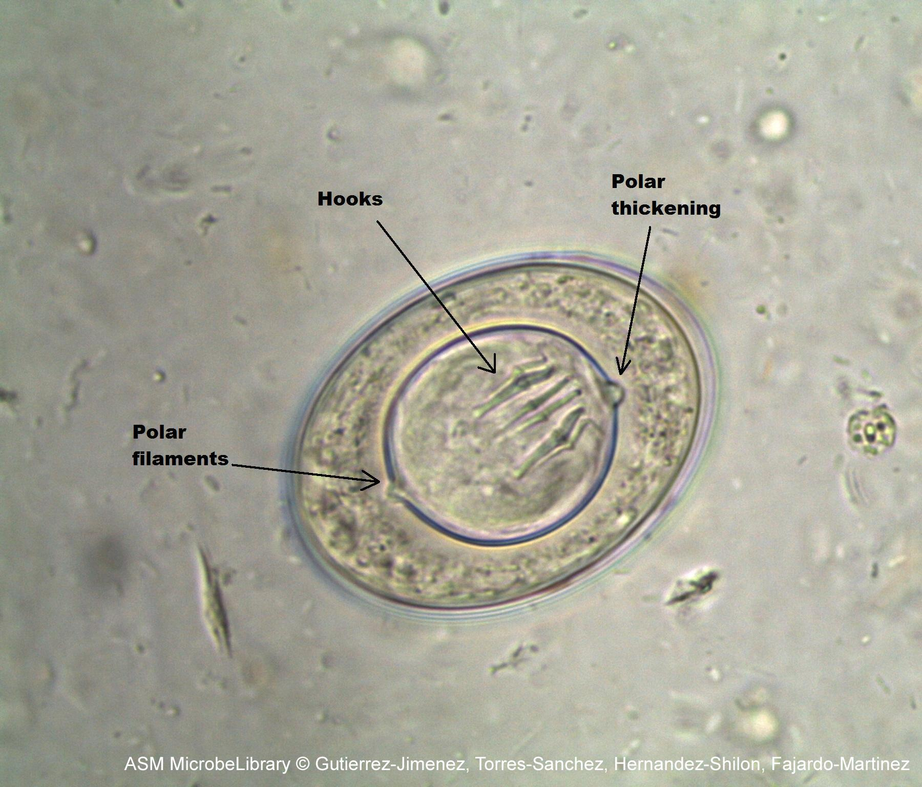 <p>double walled with polar filaments</p>