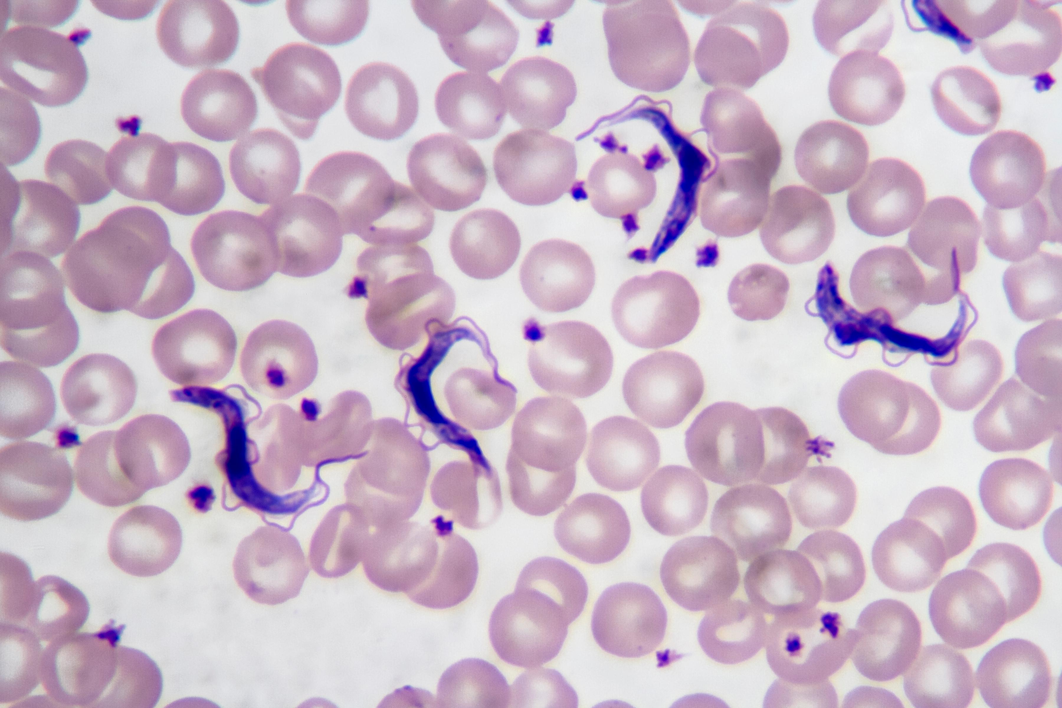 <p>Chagas disease? C-shaped trypomastigotes?</p>