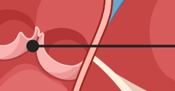 <p>What is this part of the heart?</p>