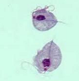 <ul><li><p>reproductive tract of cattle </p></li><li><p>causes infertility, spontaneous abortions and, pyometra </p></li></ul><p></p>