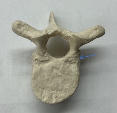 <p>What is the arrow pointing to?</p>