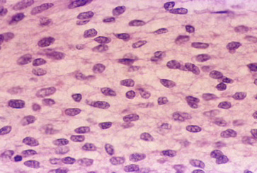 <p>Mesenchyme</p>