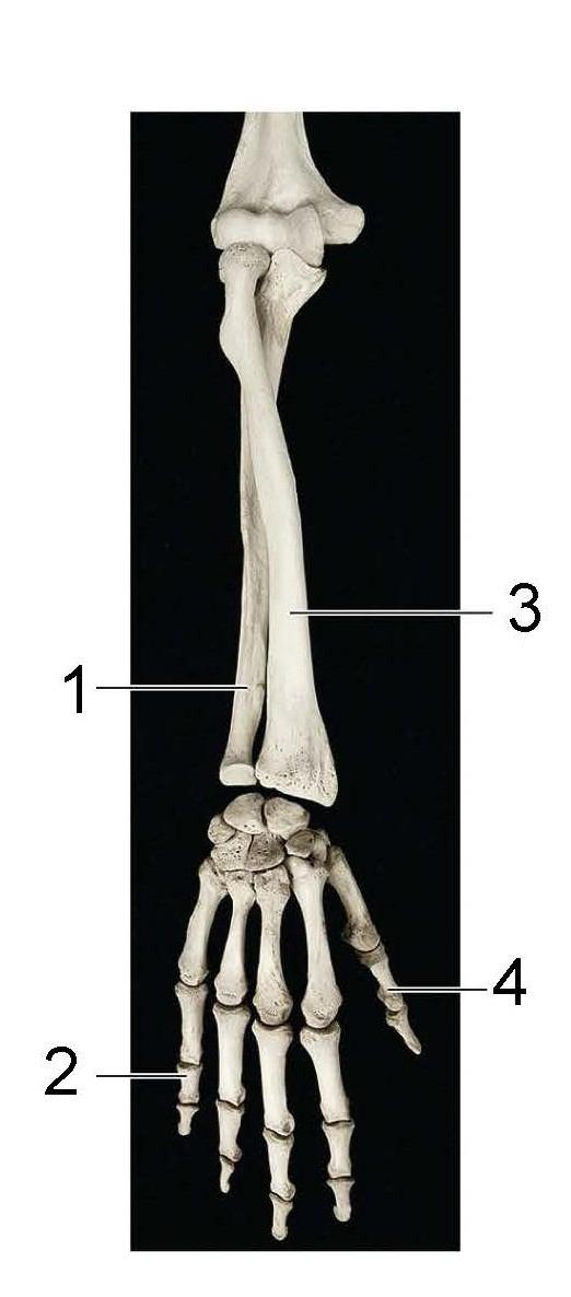 <p>What is identified in the photo (#1, #3) and anatomical position</p>