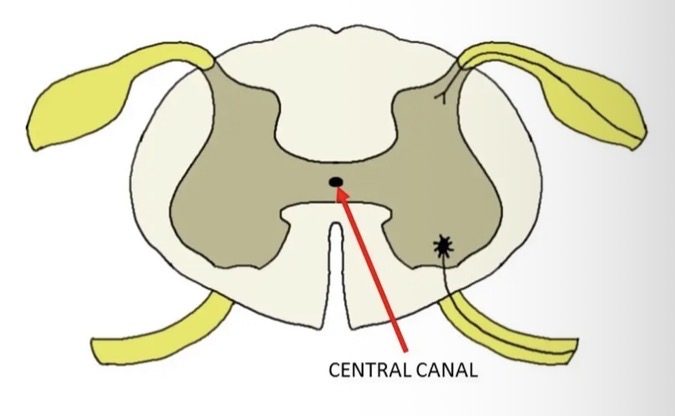 <ul><li><p>The central canal is the cerebrospinal fluid-filled space that runs through the spinal cord. </p></li><li><p>The central canal carries CSF that is rich in nutrients such as glucose. </p></li><li><p>These nutrients are delivered throughout the spinal cord via the central canal.</p></li><li><p>It also protects the spinal cord by cushioning the impact of a force on the spine.</p></li></ul><p></p>