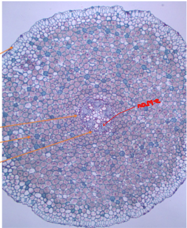 <ol><li><p>Name this part (small holes in X)</p></li></ol><p></p>