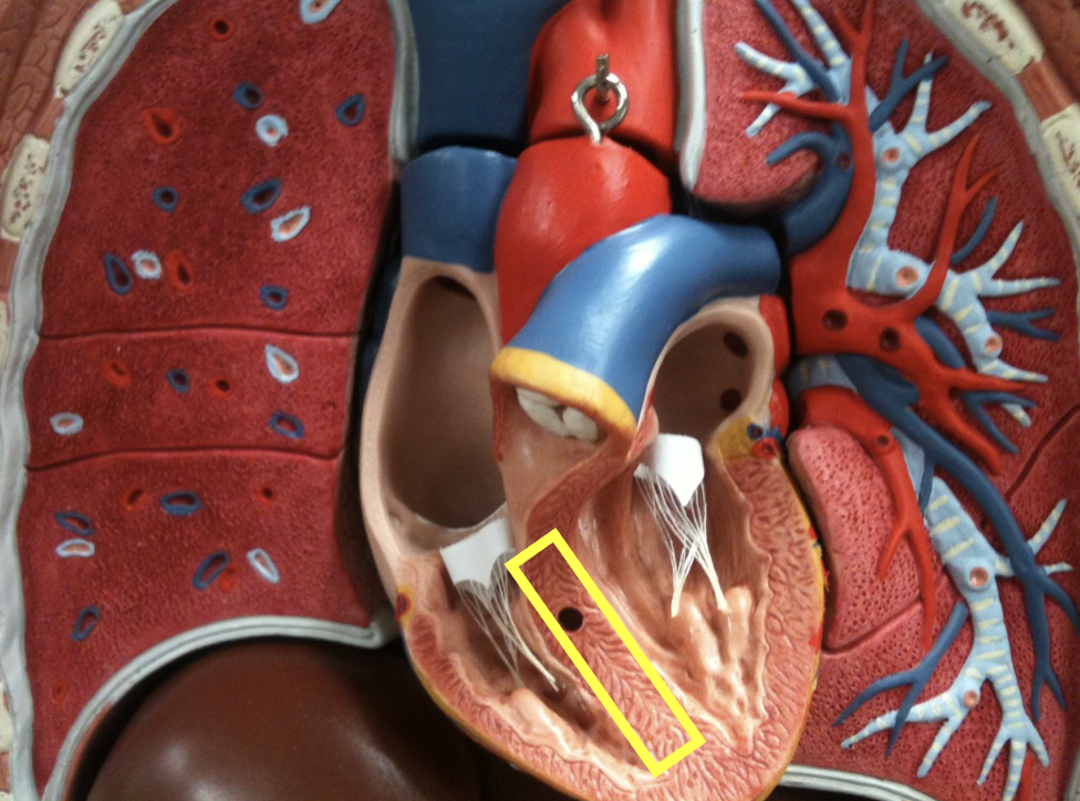 <p>what part of the heart muscle is shown?</p>