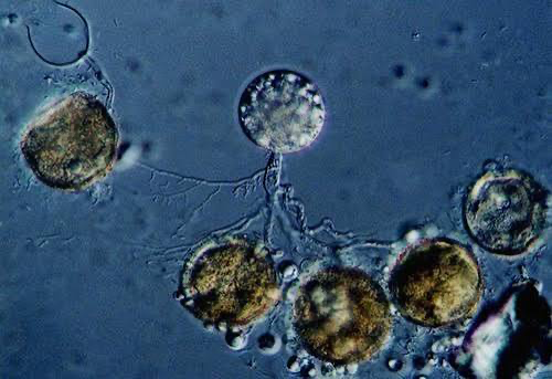 <p>water mold; phyla of fungi; only phylum with: isogamous reproduction (gametes are morphologically same), flagellated spores, isogametes, alternation of generations (sporophyte dominant- 2n); mostly saprophytic, some parasitic; inhabit moist/aquatic habitats</p>