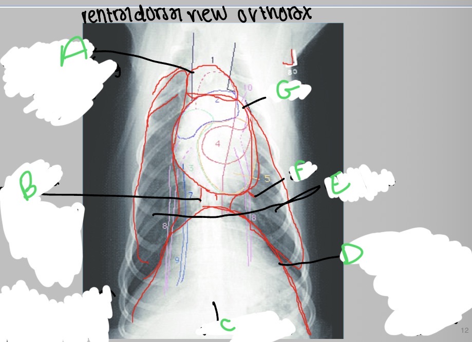 <p>Why is it white at C?</p>