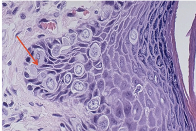 <p>What pathology?</p>