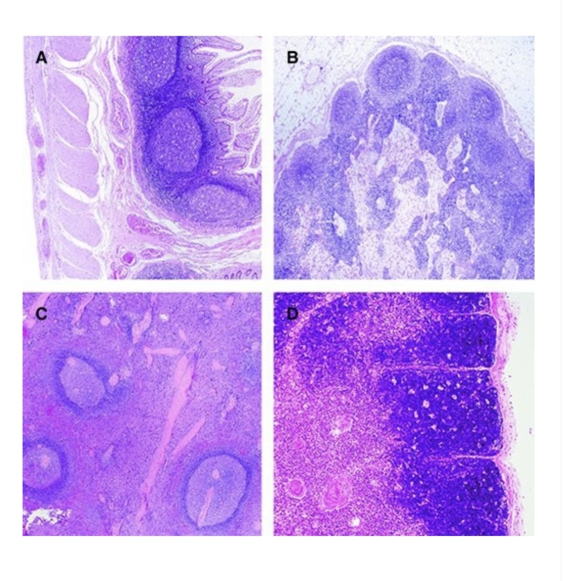 <p>What lymphatic organ/structure is identified by letter A?</p><p>&nbsp;</p><p>Thymus</p><p>&nbsp;</p><p>Spleen</p><p>&nbsp;</p><p>Lymph node</p><p>&nbsp;</p><p>Peyer's patches</p>