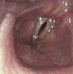 <p>what? (shows at close)</p>