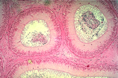 <p>histologically name the epithelium of the organ shown</p>