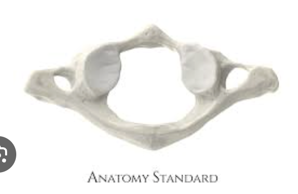 <p>Identify the vertebra</p>