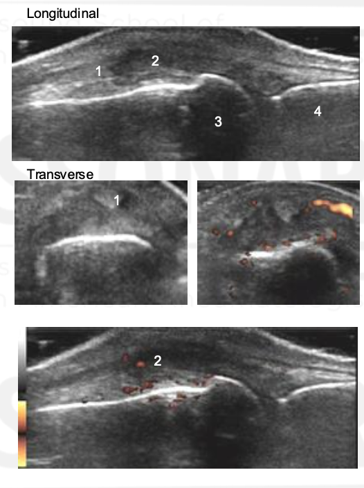 <p>What is going on here? Name 1-4.</p>