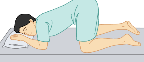<p><span>the patient is placed in the prone position and then asked to pull the knees up to a kneeling position with thighs at a 90-degree angle to the table and buttocks in the air. The head is turned to one side, and the arms may be placed under the head or on either side of the head for comfort and support. This position is used for proctologic exams, sigmoidoscopy procedures, and rectal and vaginal exams.</span></p>