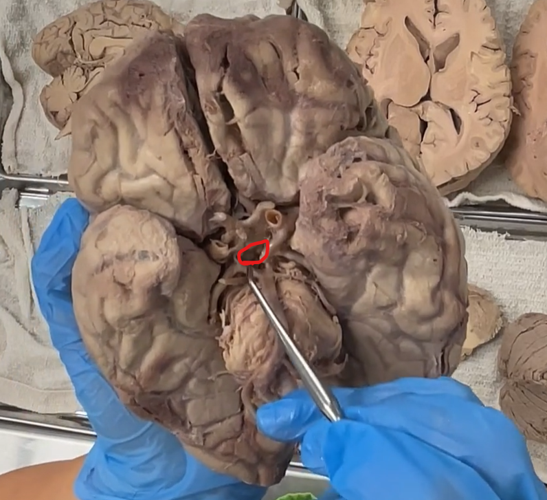 <p>red: mammillary bodies</p>