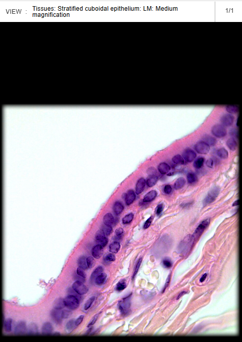 <p><span>Parotid gland</span></p>