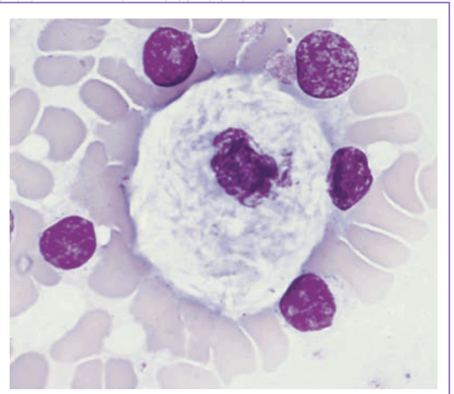 <p>Describe the morphology of a <strong>Gaucher Cell. </strong></p>