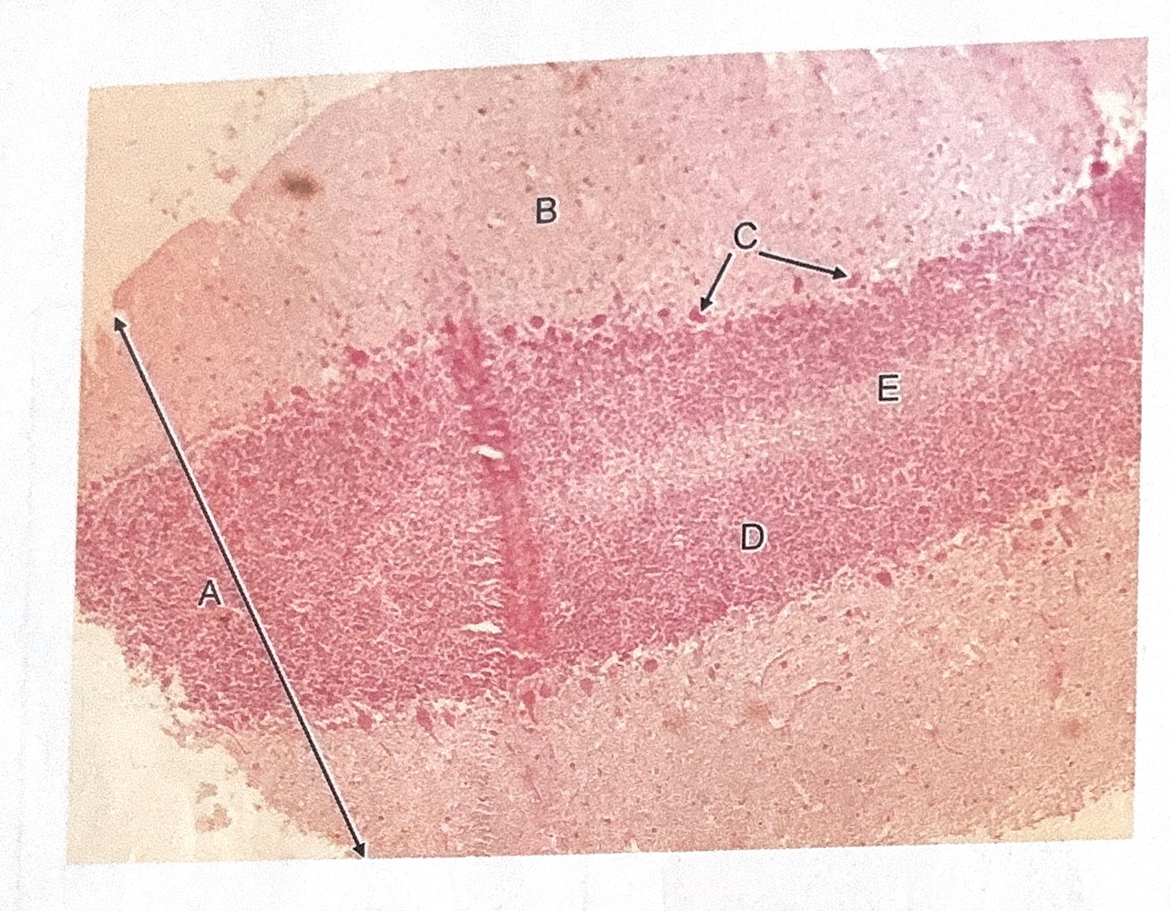 term image