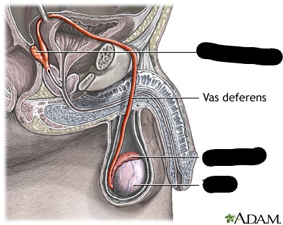 <p>Tube that carries sperm to seminal vesicle</p>