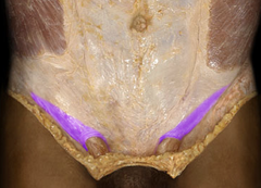 <p>Identify the structure</p>