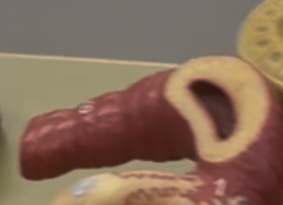 <p>appears on the afferent artery</p>