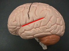 <p>Separates temporal lobe from parietal and frontal lobes</p>
